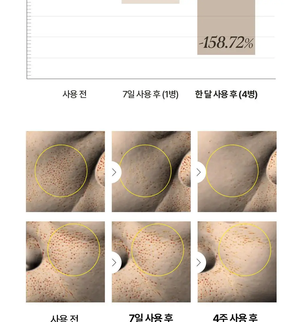 [1+1 NMN 급속모공앰플] 아떼 포어셀 프로그래밍 앰플 듀오 기획 상세페이지 33